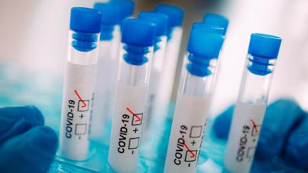Brasil recebe 500 mil testes para diagnóstico da Covid-19